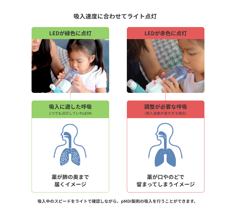 小児喘息