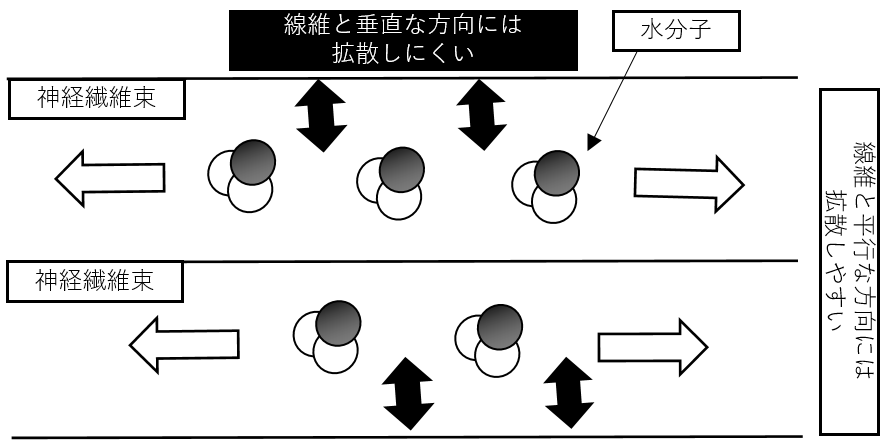 DTI、tensor、異方性、拡散方向