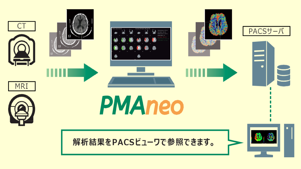 PMAneo 解析結果をPACSビューワで参照できます。